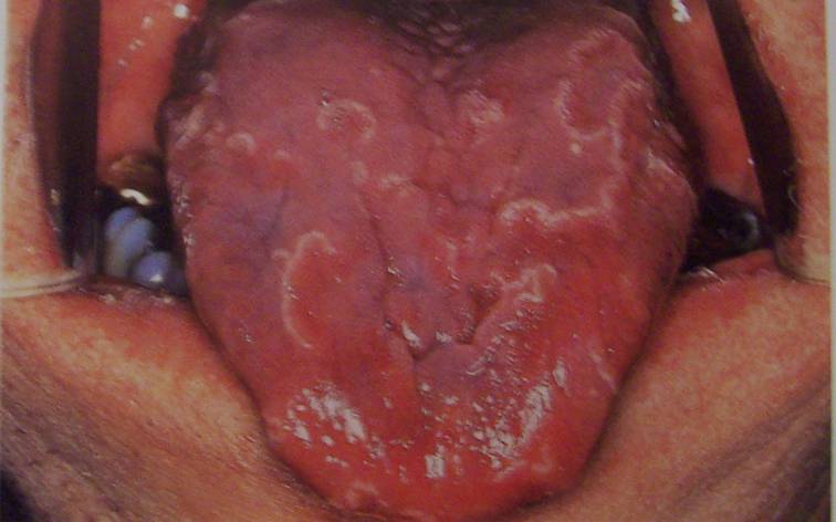 Lengua geográfica