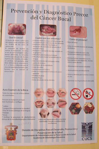 Prevención y Diagnóstico Precoz del Cáncer Bucal